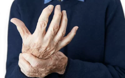 How to Treat Arthritis Pain Without Medication