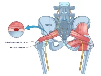 Piriformis