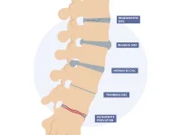 Back Pain & Sciatica